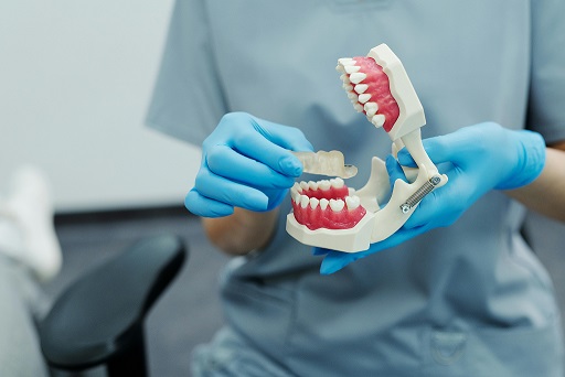 types of mouth guard explained